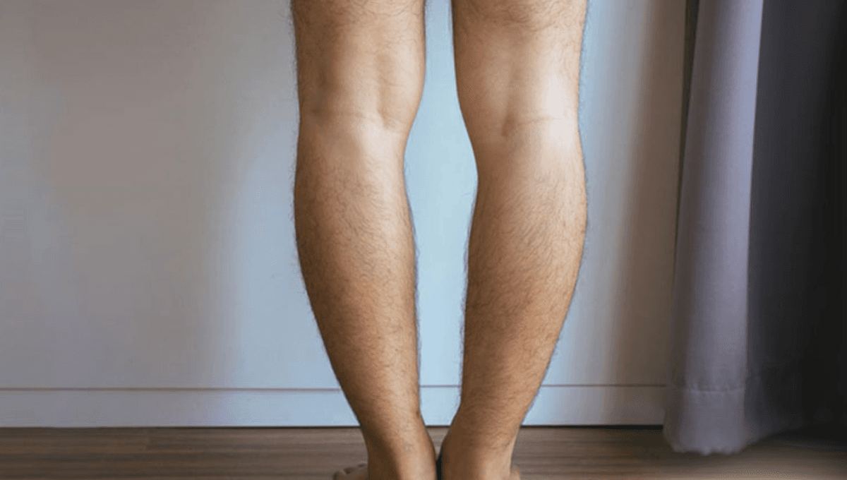 Knee Deformity Correction
